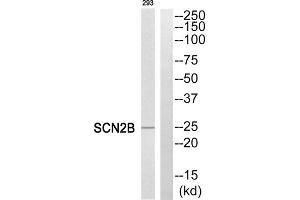 Western blot analysis of extracts from 293 cells, using SCN2B antibody. (SCN2B anticorps  (Internal Region))