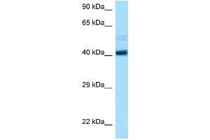 WB Suggested Anti-CCNB2 AntibodyTitration: 1. (Cyclin B2 anticorps  (C-Term))