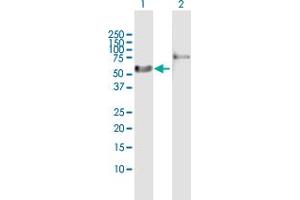 Western Blot analysis of RARA expression in transfected 293T cell line by RARA MaxPab polyclonal antibody. (Retinoic Acid Receptor alpha anticorps  (AA 1-462))