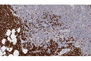 Human thymus: immunohistochemical staining for Terminal Deoxynucleotidyl Transferase. (TdT anticorps  (N-Term))