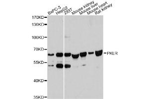 Western blot analysis of extracts of various cell lines, using PKLR antibody. (PKLR anticorps)