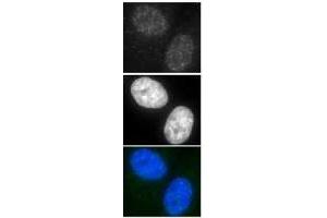 Immunofluorescence (IF) image for anti-DNA Repair Protein Homolog 1 (RAD51) antibody (ABIN2452093) (RAD51 anticorps)