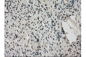 Immunohistochemical staining of paraffin-embedded colon tissue using anti-FERMT2mouse monoclonal antibody. (FERMT2 anticorps)