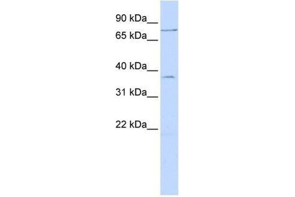 ZNF264 anticorps  (N-Term)