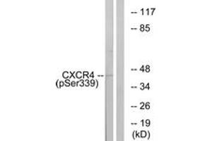 Western blot analysis of extracts from HuvEc cells treated with etoposide 25uM 24H, using CXCR4 (Phospho-Ser339) Antibody. (CXCR4 anticorps  (pSer339))