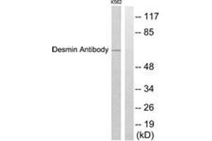 Western blot analysis of extracts from K562 cells, using Desmin Antibody. (Desmin anticorps  (AA 421-470))
