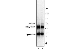 Immunoprecipitation (IP) image for anti-SMAD Family Member 4 (SMAD4) (N-Term) antibody (ABIN6972727)