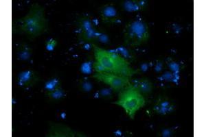 Anti-DYNC1LI1 mouse monoclonal antibody (ABIN2452970) immunofluorescent staining of COS7 cells transiently transfected by pCMV6-ENTRY DYNC1LI1 (RC222010). (DYNC1LI1 anticorps)