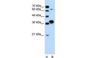 Western Blotting (WB) image for anti-FOS-Like Antigen 1 (FOSL1) antibody (ABIN2460206) (FOSL1 anticorps)