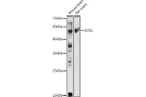 Western blot analysis of extracts of various cell lines, using SOX1 antibody (ABIN3017344, ABIN3017345, ABIN3017346 and ABIN1682856) at 1:1000 dilution. (SOX1 anticorps)