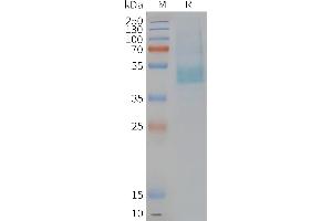 Human CM-Nanodisc, Flag Tag on SDS-PAGE (CMKLR1 Protéine)
