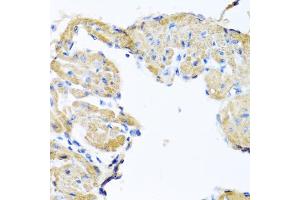 Immunohistochemistry of paraffin-embedded mouse heart using GPLD1 antibody. (GPLD1 anticorps)