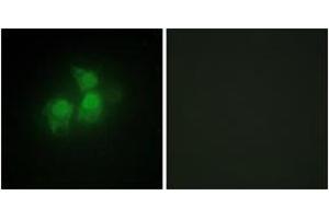 Immunofluorescence analysis of HepG2 cells, using IPPK Antibody. (IPPK anticorps  (AA 11-60))