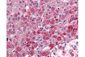 Anti-CCKAR antibody IHC of human adrenal. (CCKAR anticorps  (Internal Region))