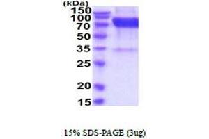 SDS-PAGE (SDS) image for Fibroblast Growth Factor Receptor 4 (FGFR4) (AA 22-369) protein (His tag) (ABIN5854679) (FGFR4 Protein (AA 22-369) (His tag))