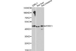 Western blot analysis of extracts of various cell lines, using P2RY1 antibody. (P2RY1 anticorps)