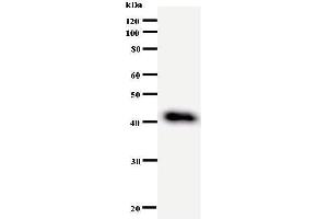 Western Blotting (WB) image for anti-DEAD (Asp-Glu-Ala-Asp) Box Polypeptide 27 (DDX27) antibody (ABIN933004) (DDX27 anticorps)