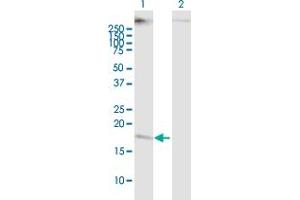 Western Blot analysis of CMTM5 expression in transfected 293T cell line ( H00116173-T01 ) by CMTM5 MaxPab polyclonal antibody. (CMTM5 anticorps  (AA 1-156))