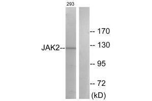 Western blot analysis of extracts from 293 cells, treated with etoposide (25uM, 24hours), using JAK2 (Ab-570) antibody. (JAK2 anticorps  (Tyr570))