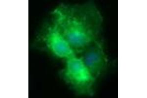 Image no. 3 for anti-CD19 Molecule (CD19) antibody (ABIN1497183) (CD19 anticorps)