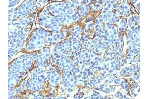 Image no. 1 for anti-Nerve Growth Factor Receptor (NGFR) antibody (ABIN6158430) (NGFR anticorps)
