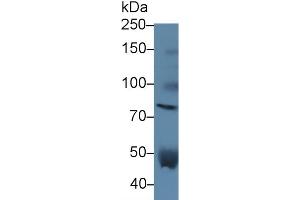 Detection of VCAN in Human Serum using Polyclonal Antibody to Versican (VCAN) (Versican anticorps  (AA 2958-3209))