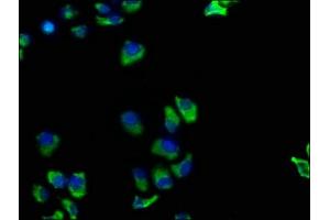 Immunofluorescence staining of Hela cells with ABIN7173872 at 1:100, counter-stained with DAPI. (TNFRSF1A anticorps  (AA 249-455))