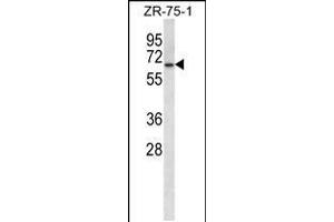 Western blot analysis in ZR-75-1 cell line lysates (35ug/lane). (GPD2 anticorps  (C-Term))