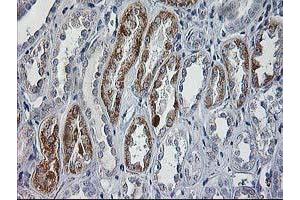 Immunohistochemical staining of paraffin-embedded Human Kidney tissue using anti-CCM2 mouse monoclonal antibody. (CCM2 anticorps)