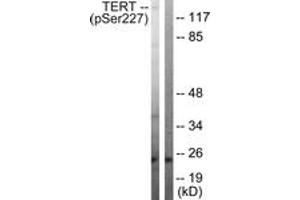 Western Blotting (WB) image for anti-Telomerase Reverse Transcriptase (TERT) (AA 196-245), (pSer227) antibody (ABIN482341) (TERT anticorps  (pSer227))