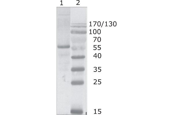 HIV-1 p24 anticorps  (N-Term)
