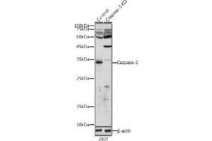 Western blot analysis of extracts from normal (control) and Caspase-3 knockout (KO) 293T cells, using Caspase-3 antibody (ABIN6131582, ABIN6137962, ABIN6137964 and ABIN6215049) at 1:1000 dilution. (Caspase 3 anticorps  (AA 55-160))