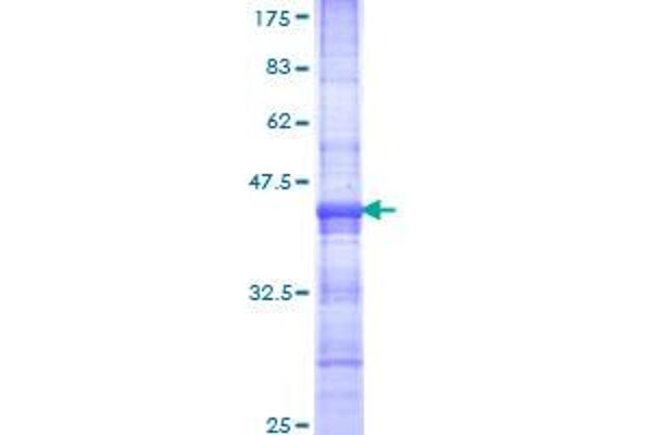 MTA3 Protein (AA 416-515) (GST tag)