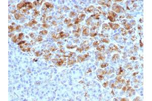 Formalin-fixed, paraffin-embedded human Pancreas stained with Alpha-1-Antichymotrypsin Mouse Monoclonal Antibody (AACT/1452) (SERPINA3 anticorps  (AA 49-187))