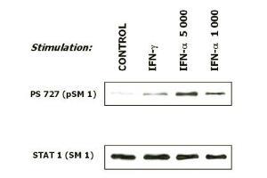 Induction of phosphorylation of STAT 1 at Ser727 in human malignant melanoma cells (short-term culture derived from a patient) in response to interferons. (STAT1 anticorps  (pSer727))