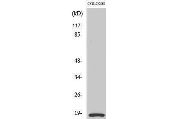 MYL12B anticorps  (Ser1179)