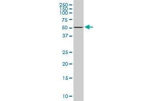 Western Blotting (WB) image for anti-DEAD (Asp-Glu-Ala-Asp) Box Polypeptide 56 (DDX56) (AA 450-547) antibody (ABIN527138)