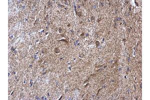 IHC-P Image NDUFV2 antibody detects NDUFV2 protein at mitochondria on mouse fore brain by immunohistochemical analysis. (NDUFV2 anticorps  (Center))