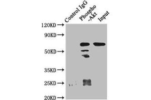 Western Blotting (WB) image for anti-V-Akt Murine Thymoma Viral Oncogene Homolog 1 (AKT1) (pSer473) antibody (ABIN7127677)