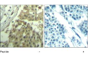 Image no. 1 for anti-Cyclin-Dependent Kinase 1 (CDK1) (Tyr19) antibody (ABIN319406) (CDK1 anticorps  (Tyr19))