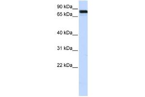 WB Suggested Anti-EWSR1 Antibody Titration:  0. (EWSR1 anticorps  (Middle Region))