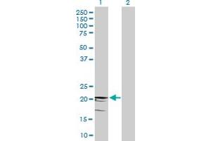 Western Blot analysis of CD3D expression in transfected 293T cell line by CD3D MaxPab polyclonal antibody. (CD3D anticorps  (AA 1-171))