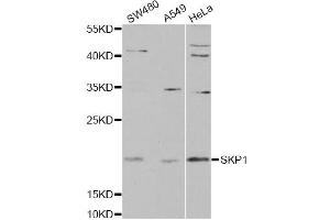 Western blot analysis of extracts of various cell lines, using SKP1 antibody. (SKP1 anticorps)