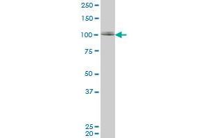 ZNF281 monoclonal antibody (M02), clone 1C9. (ZNF281 anticorps  (AA 787-893))