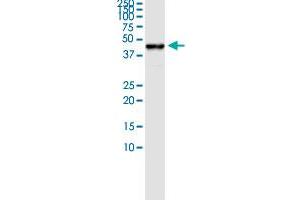 Immunoprecipitation of MVD transfected lysate using rabbit polyclonal anti-MVD and Protein A Magnetic Bead ( U0007 ), and immunoblotted with mouse purified polyclonal anti-MVD. (MVD (Humain) IP-WB Antibody Pair)