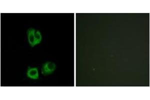 Immunofluorescence (IF) image for anti-Lymphocyte-Specific Protein tyrosine Kinase (LCK) (pTyr393) antibody (ABIN2888462) (LCK anticorps  (pTyr393))