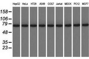 Western blot analysis of extracts (35 µg) from 9 different cell lines by using anti-KBTBD7 monoclonal antibody. (KBTBD7 anticorps)