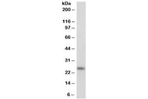 Western blot testing of human skeletal muscle lysate with TNNI1 antibody at 0. (TNNI1 anticorps)