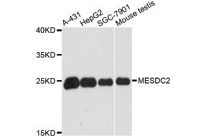 Western blot analysis of extracts of various cell lines, using MESDC2 antibody. (MESDC2 anticorps)