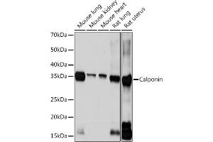 Western blot analysis of extracts of various cell lines, using Calponin Rabbit mAb (ABIN1678670, ABIN3018018, ABIN3018019 and ABIN7101568) at 1:1000 dilution. (CNN1 anticorps)